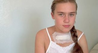 Картинка по теме - как нормализовать щитовидную железу