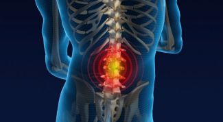 Картинка по теме - как избавиться от позвоночной грыжи