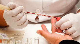 Картинка по теме - как определить сифилис