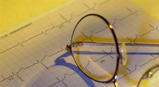 Картинка по теме - как разобраться в результатах кардиограммы сердца