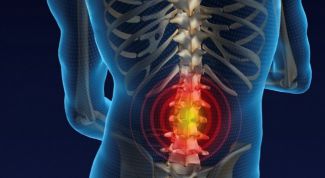 Картинка по теме - как лечить грыжу позвоночника