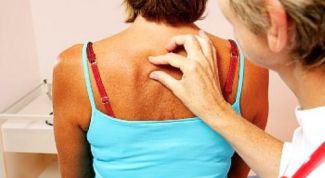 Картинка по теме - как лечить лишаи на теле