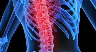 Картинка по теме - как распознать искривление позвоночника