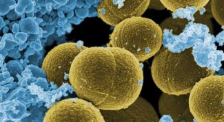 Картинка по теме - как вывести стафилококк