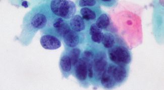 Картинка по теме - что такое рак