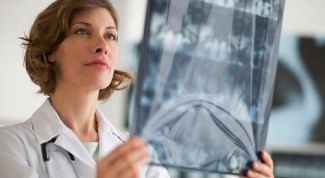 Картинка по теме - как лечить жировой гепатоз печени