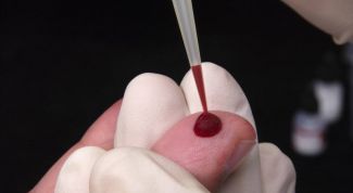 Картинка по теме - как определить анемию