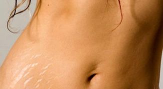 Картинка по теме - как выбрать крем от растяжек