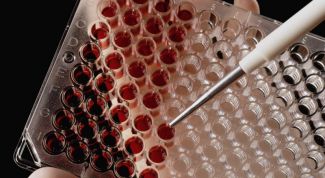 Картинка по теме - как сдать кровь на гормоны