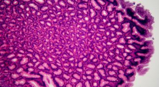 Картинка по теме - почему появляется слизь