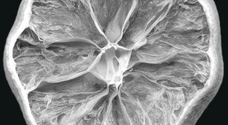 Картинка по теме - как определить нехватку витаминов