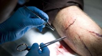 Картинка по теме - как лечить резаные раны