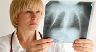 Картинка по теме - как лечить туберкулез у детей