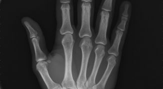 Картинка по теме - как определить содержание кальция