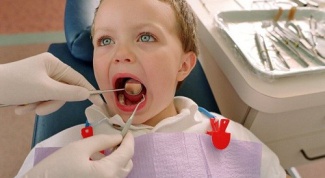 Картинка по теме - как лечить кариес ребенку в 2 года