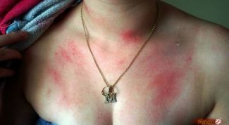 Медовый массаж? Осторожно!