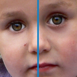У ребенка темные круги под глазами почему. Тёмные круги под глазами у ребёнка. Мешки под глазами у ребенка. Синие круги под глазами у ребенка.