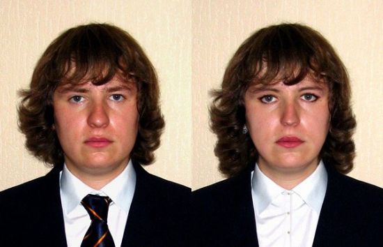 Как меняют пол с мужчины на женщину операция фото до и после