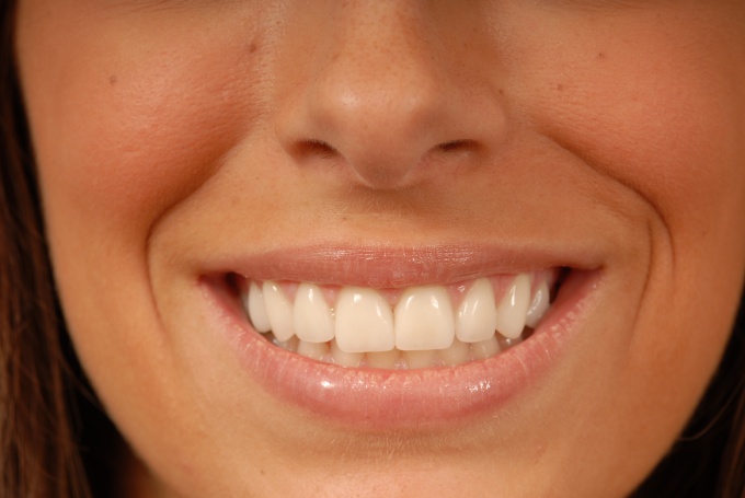 How to get rid of gaps between teeth