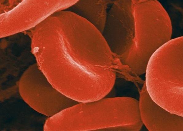 Почему повышается гемоглобин