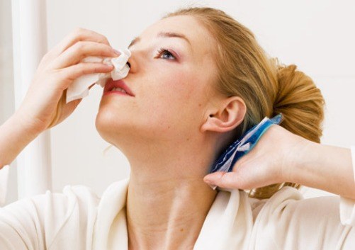Как лечить носовое кровотечение