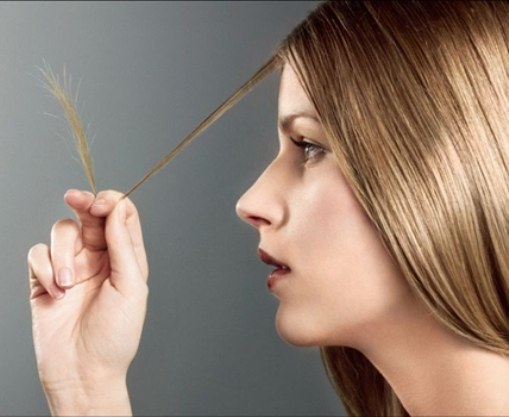 How to treat hair loss in women