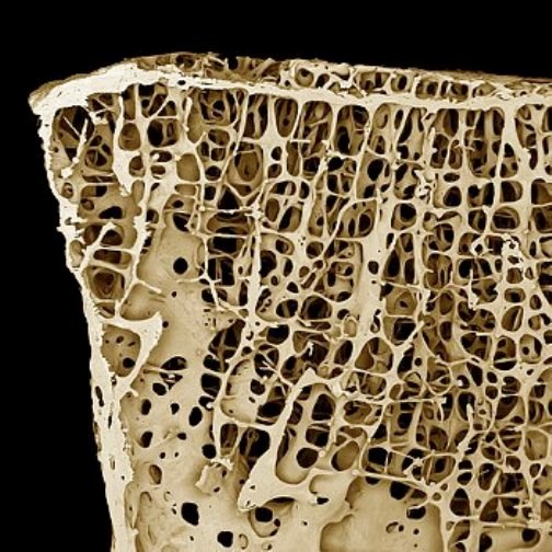 Как восстановить костную ткань