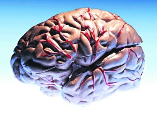 Что такое инсульт мозга