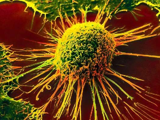 Что такое раковая клетка 