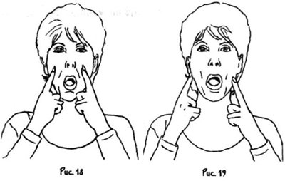 How to remove nasolabial folds