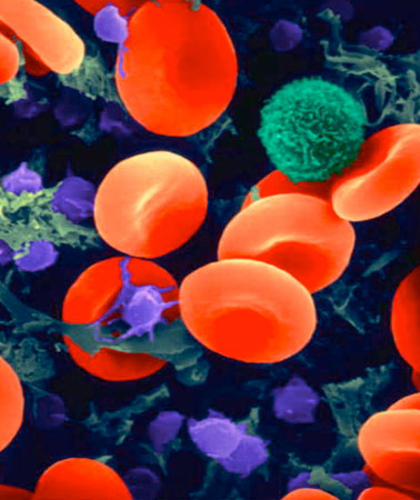 Как поднять лейкоциты крови?