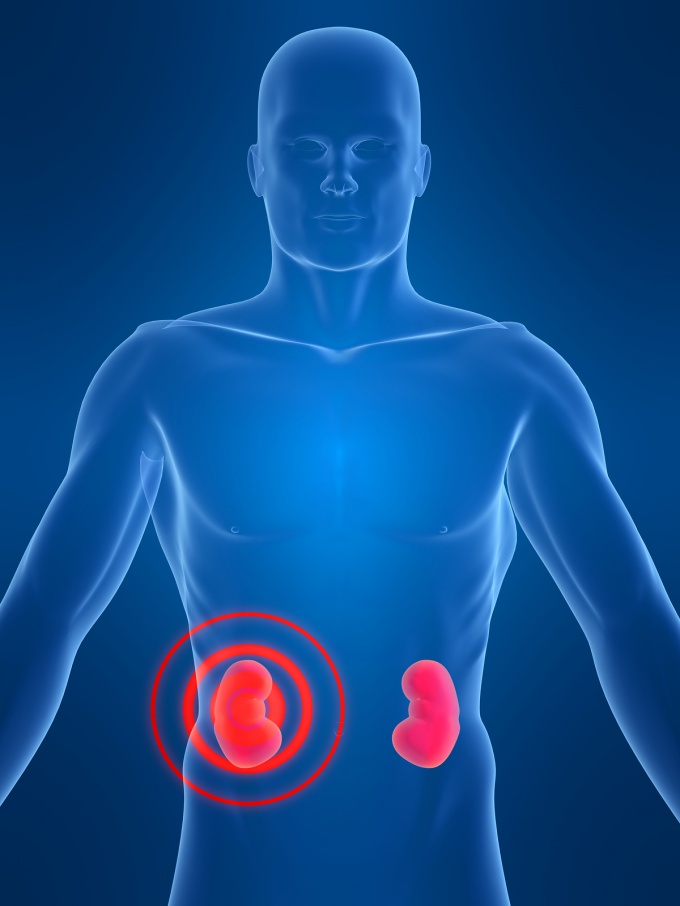 How to crush kidney stones