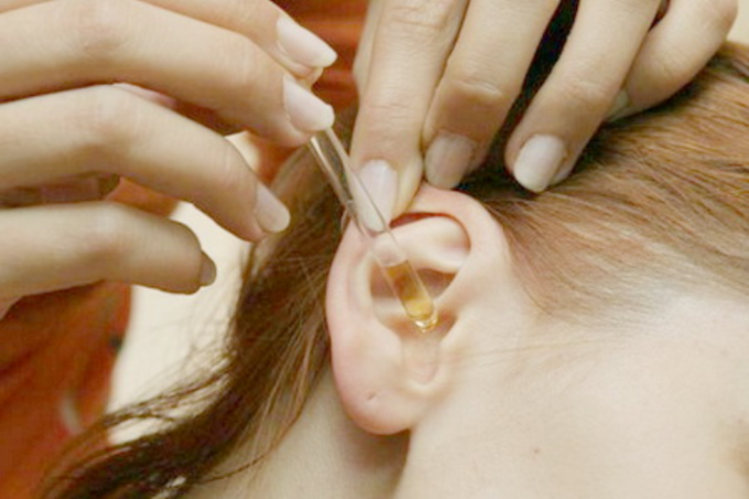 How to remove at home sulfur plugs out of your ears