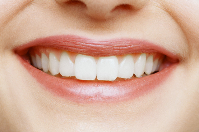 How to remove the gap between the <b>front</b> <em>teeth</em>