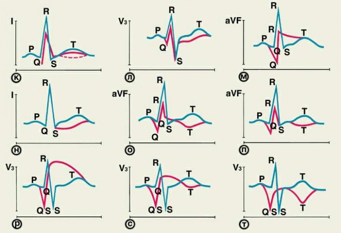 How to read <strong>echo</strong>