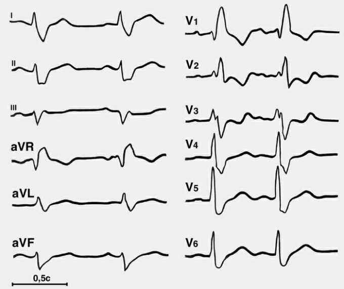 How to read <strong>echo</strong>