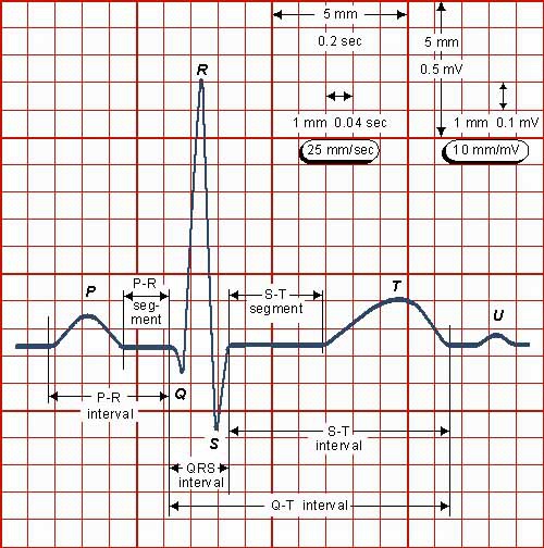 How to read an EKG