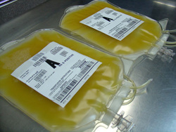 How to take <strong>blood</strong> <b><em>plasma</em></b>