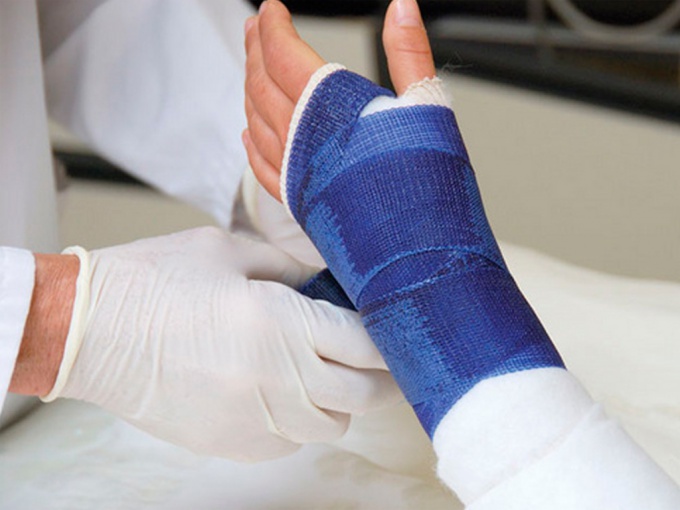 How to apply a splint at fracture