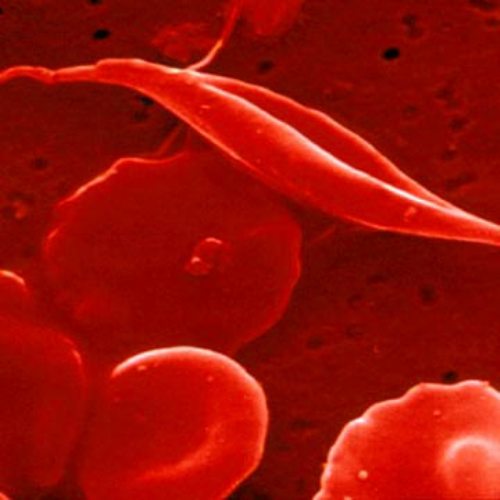 How to lower red blood cells