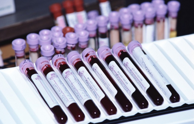 How to pass the clinical analysis of blood