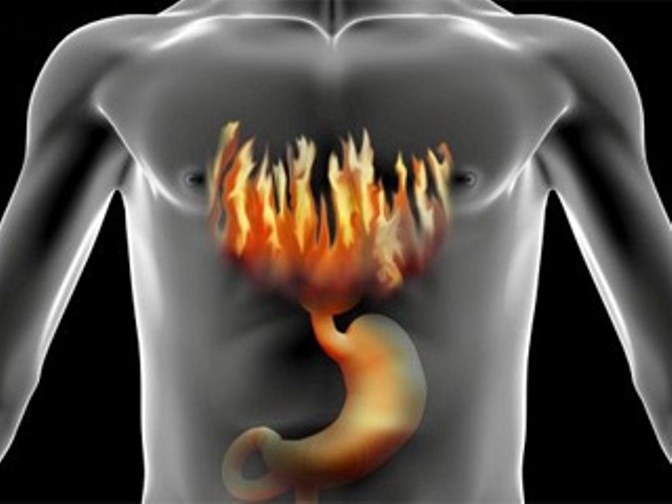 Как проверить кислотность желудка ? проверка кислотности желудка ? Здоровье и медицина ? Другое