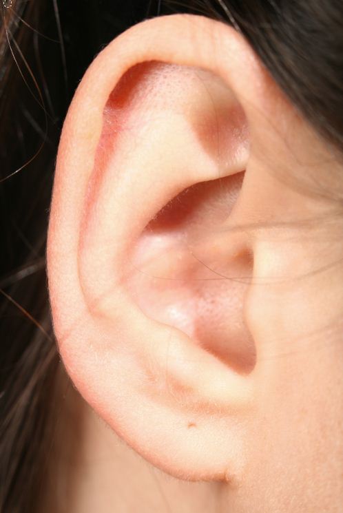 Как избавиться от черных точек в ушах