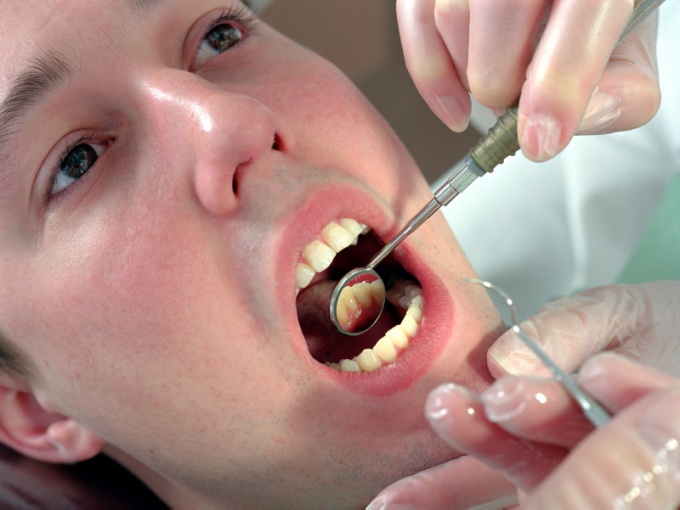 How to cure tooth cyst
