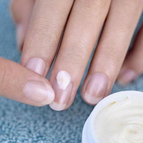 How to get rid of fungus on fingernails