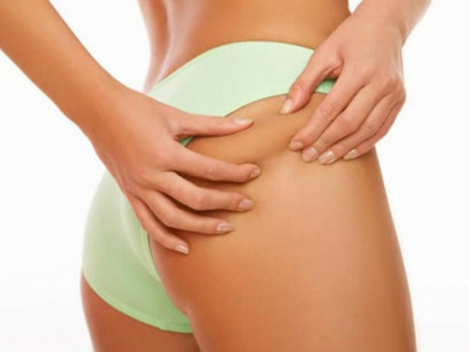 How to get rid of the newly-appeared stretch marks