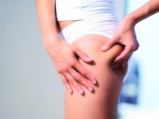 How to get rid of cellulite on buttocks