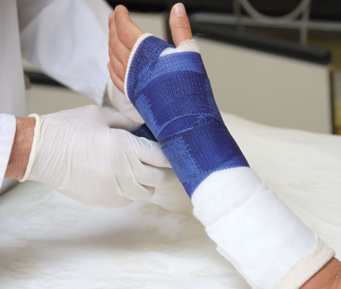 How to remove swelling after a fracture