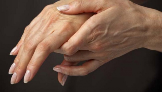 How to treat carpal tunnel syndrome