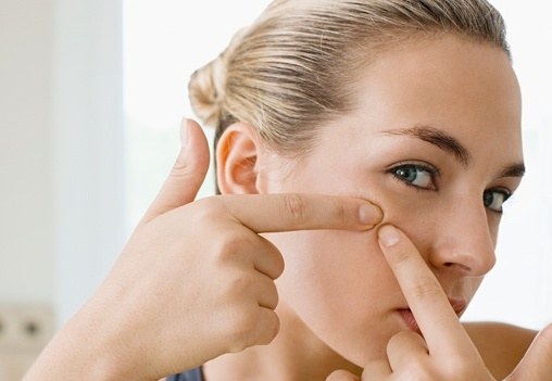 How to get rid of red pimple